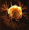 breast-cancer-cell.jpg (33897 bytes)